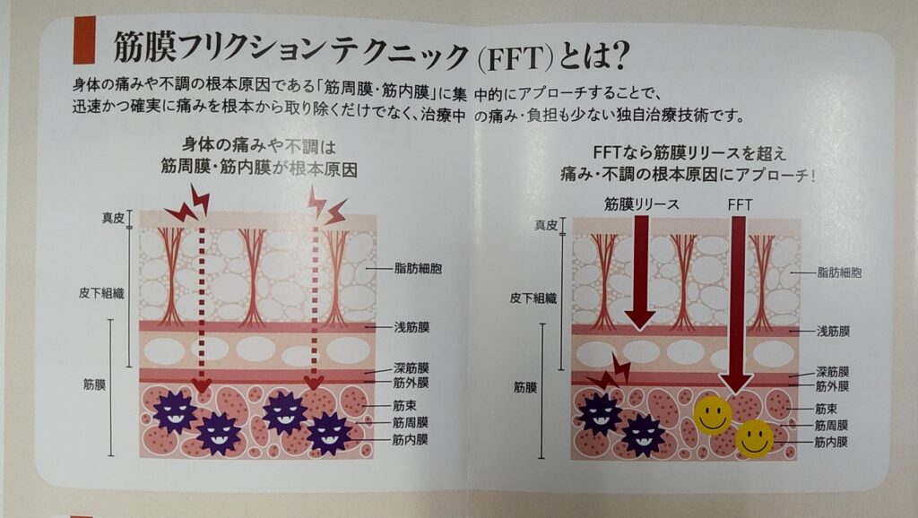 FFTについて