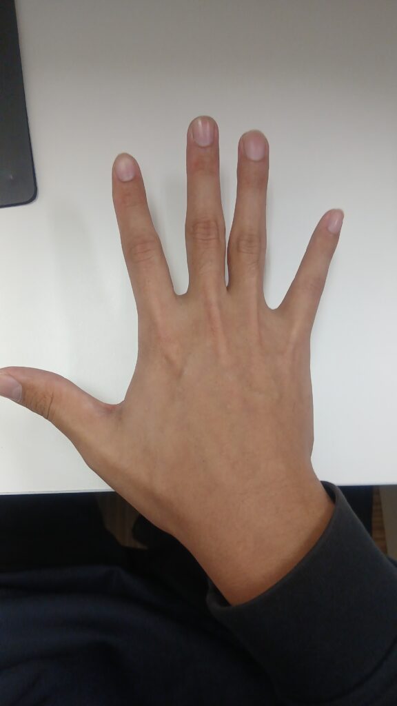 セルフチェック