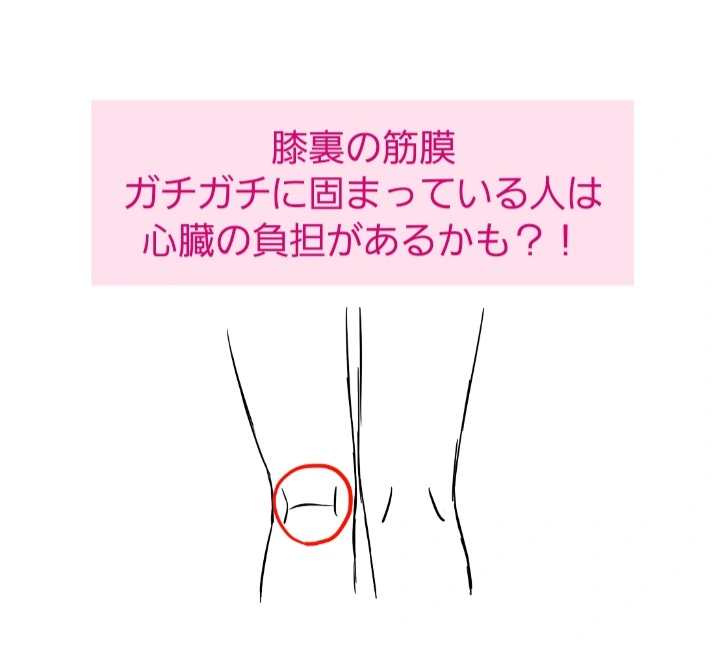 膝裏の筋膜の硬さ